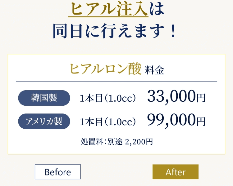ヒアル注入は