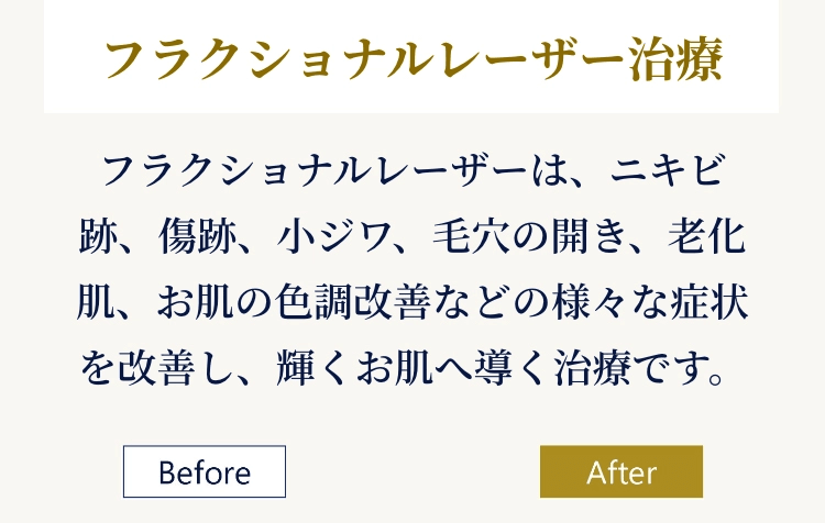 フラクショナルレーザー治療